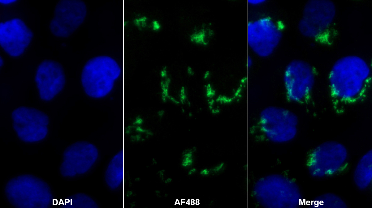 Monoclonal Antibody to Monokine Induced By Interferon Gamma (MIg)