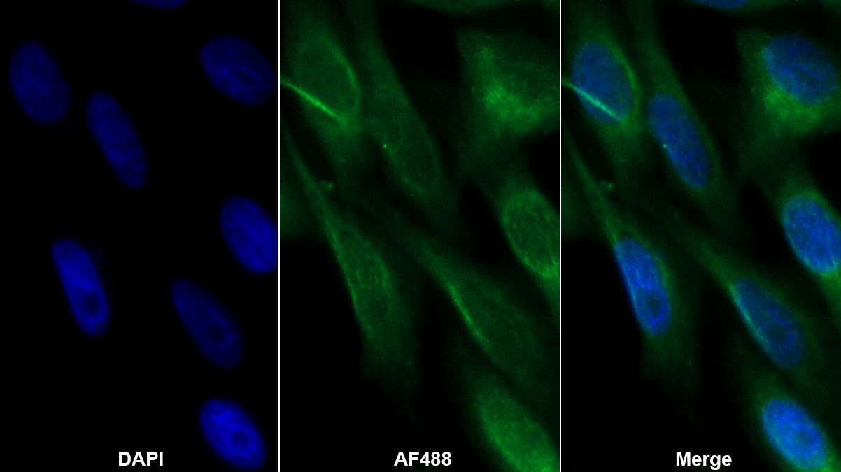 Monoclonal Antibody to Leucine Rich Alpha-2-Glycoprotein 1 (LRG1)