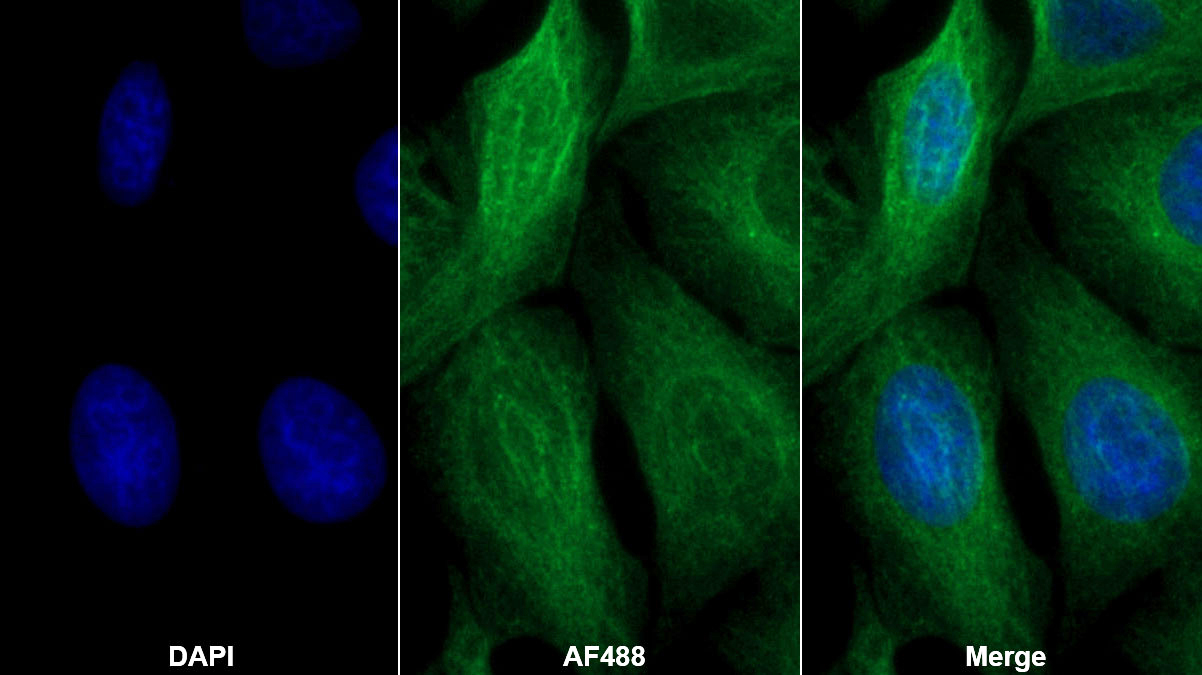 Monoclonal Antibody to Transforming Growth Factor Beta 3 (TGFb3)