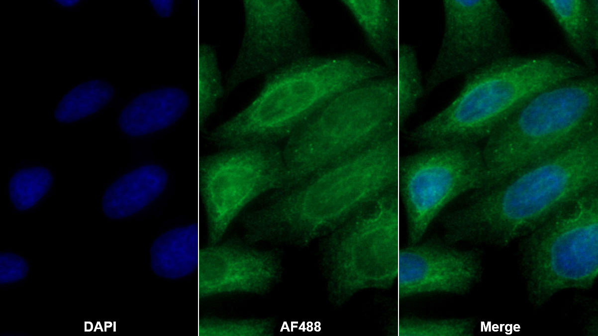 Monoclonal Antibody to Transforming Growth Factor Beta 3 (TGFb3)