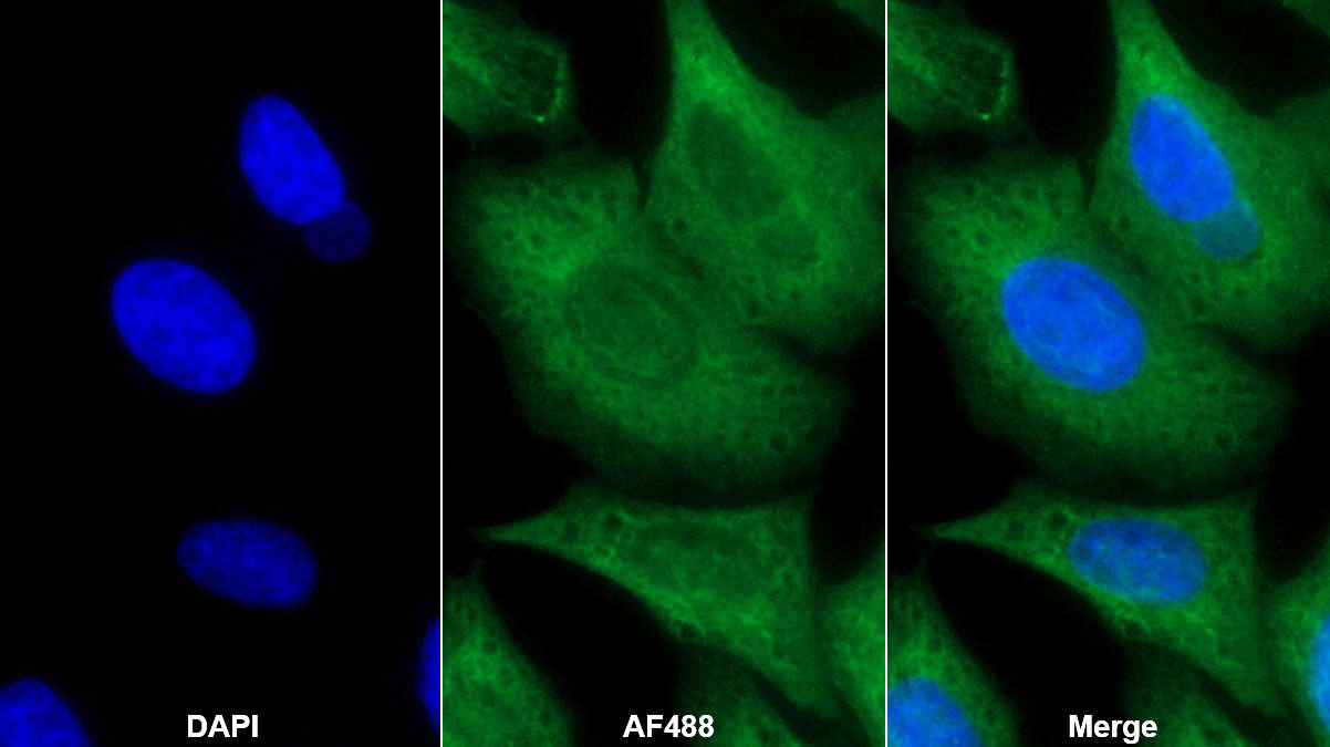 Monoclonal Antibody to Transforming Growth Factor Beta 3 (TGFb3)