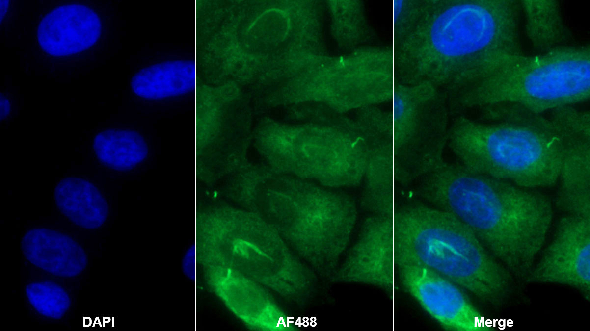 Monoclonal Antibody to Transforming Growth Factor Beta 3 (TGFb3)