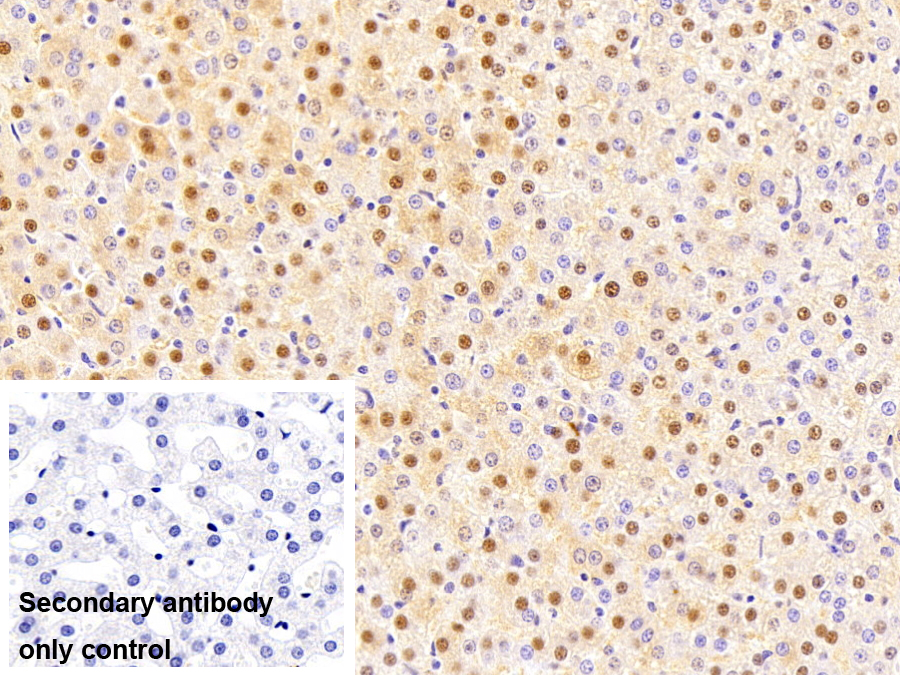 Monoclonal Antibody to Superoxide Dismutase 1 (SOD1)