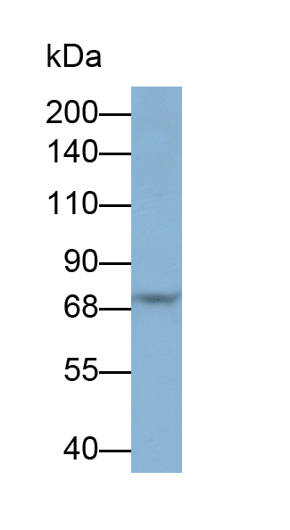 Monoclonal Antibody to Complement Component 5 (C5)