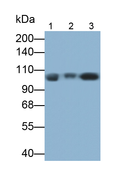 Monoclonal Antibody to Complement Component 5 (C5)