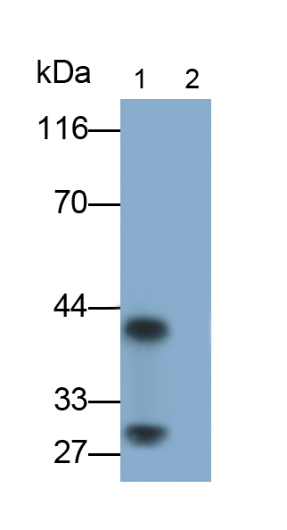 Monoclonal Antibody to Interleukin 33 (IL33)