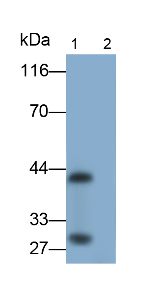 Monoclonal Antibody to Interleukin 33 (IL33)