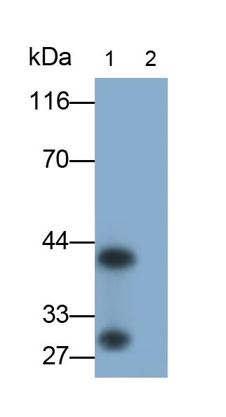 Monoclonal Antibody to Interleukin 33 (IL33)