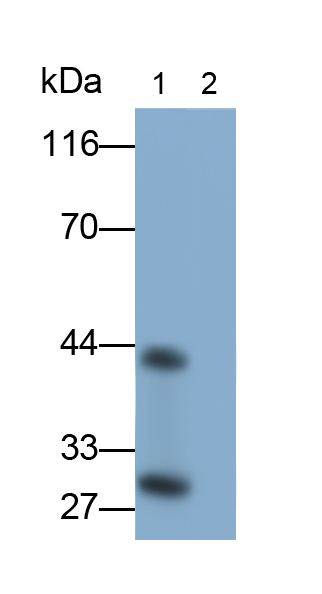 Monoclonal Antibody to Interleukin 33 (IL33)