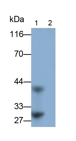 Monoclonal Antibody to Interleukin 33 (IL33)