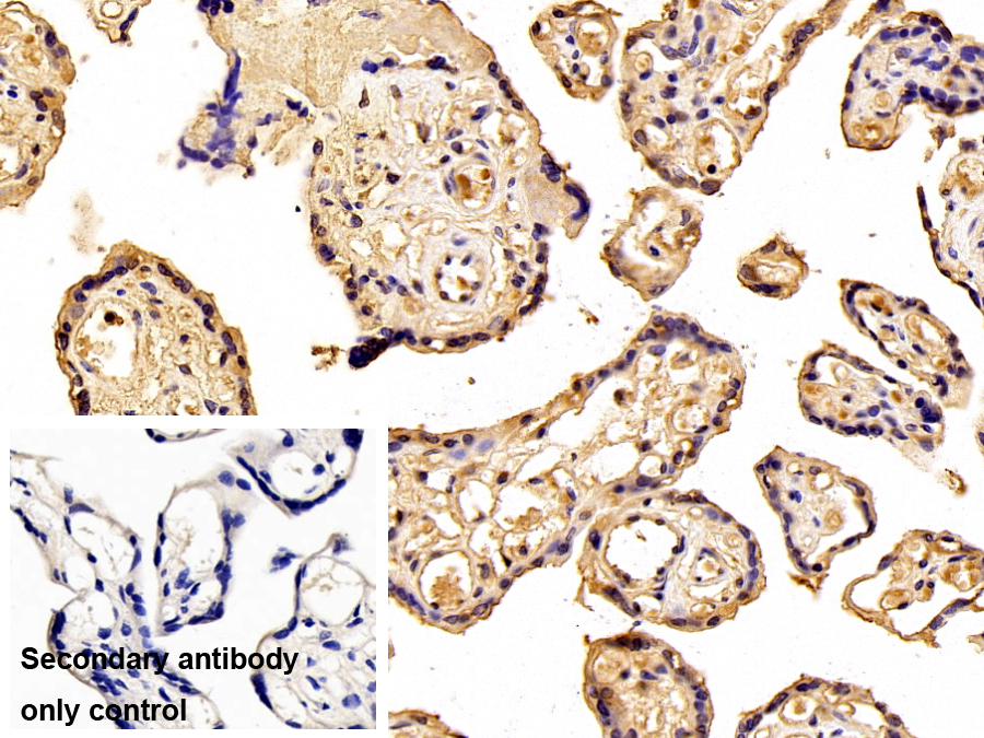 Monoclonal Antibody to Hemopexin (HPX)