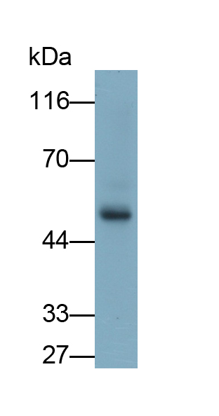 Monoclonal Antibody to Arrestin Beta 2 (ARRb2)