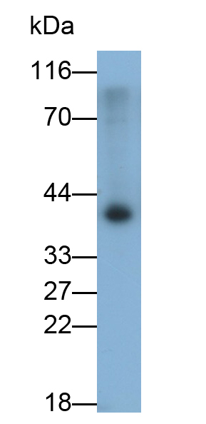 Monoclonal Antibody to Hemojuvelin (HJV)