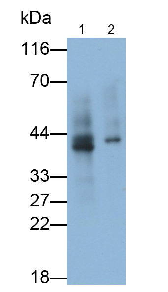 Monoclonal Antibody to Hemojuvelin (HJV)