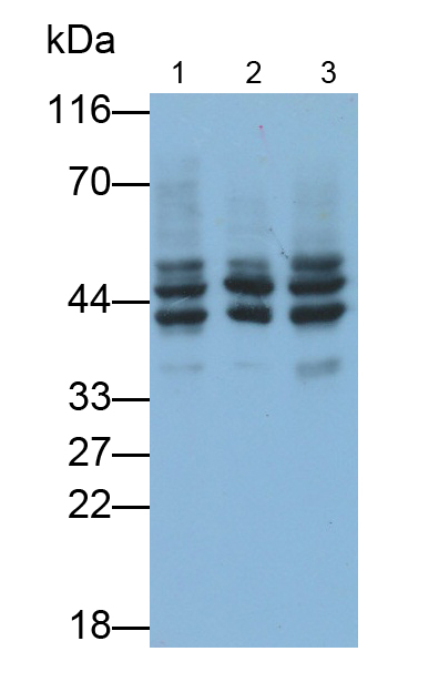 Monoclonal Antibody to Hemojuvelin (HJV)