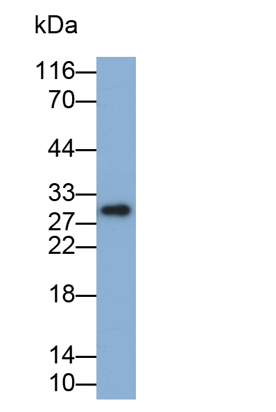 Monoclonal Antibody to Interleukin 35 (IL35)