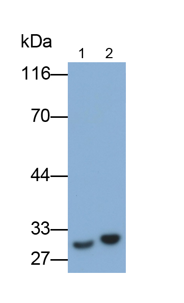 Monoclonal Antibody to Interleukin 35 (IL35)