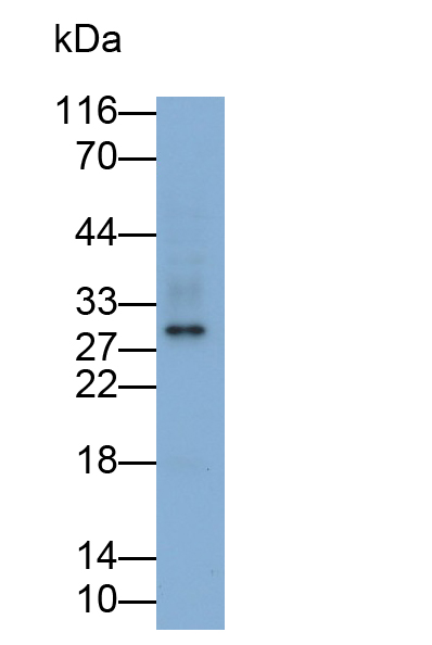 Monoclonal Antibody to Interleukin 35 (IL35)