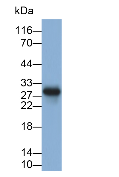 Monoclonal Antibody to Interleukin 35 (IL35)