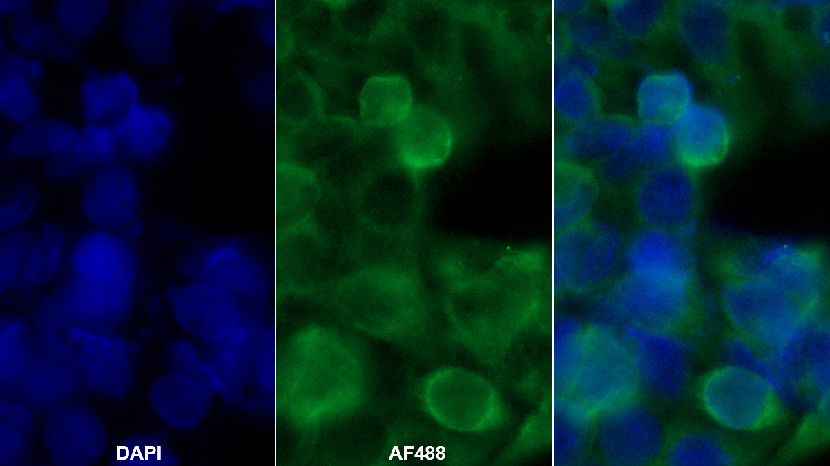 Monoclonal Antibody to Serpin A10 (SERPINA10)