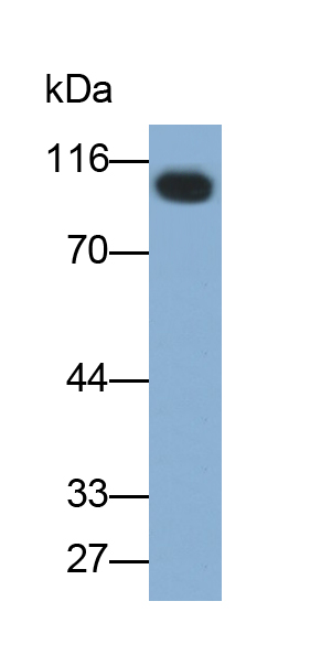 Monoclonal Antibody to Complement Factor B (CFB)
