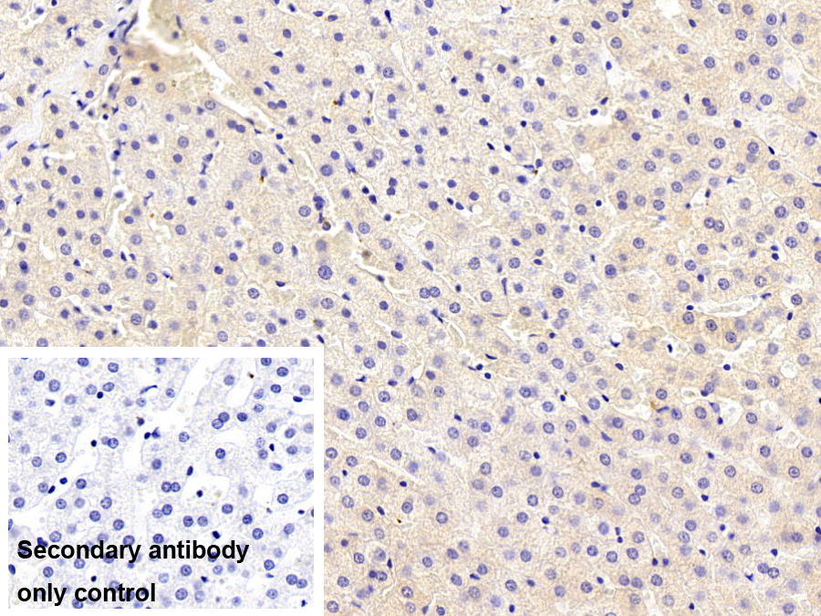 Monoclonal Antibody to Complement Factor B (CFB)