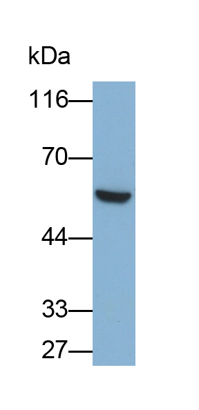 Monoclonal Antibody to Aldehyde Dehydrogenase, Mitochondrial (ALDH2)