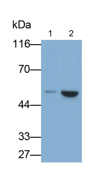 Monoclonal Antibody to Cytokeratin 8 (CK8)