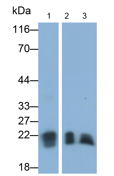 Monoclonal Antibody to O-6-Methylguanine DNA Methyltransferase (MGMT)
