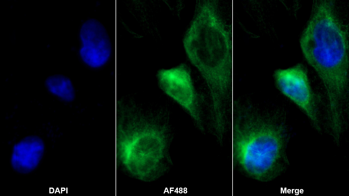 Monoclonal Antibody to Creatine Kinase B (CK-BB)