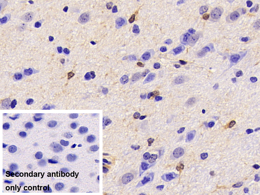 Monoclonal Antibody to Creatine Kinase B (CK-BB)