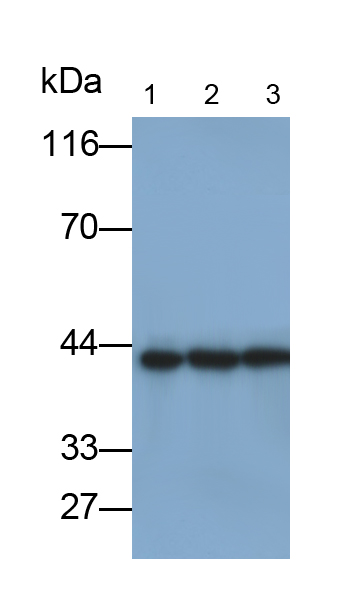 Monoclonal Antibody to Creatine Kinase B (CK-BB)