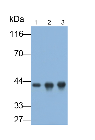 Monoclonal Antibody to Creatine Kinase B (CK-BB)