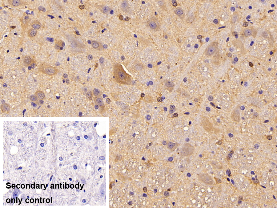 Monoclonal Antibody to Creatine Kinase B (CK-BB)