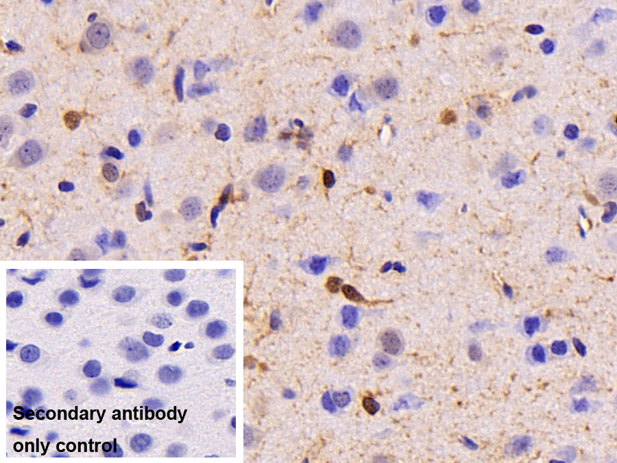 Monoclonal Antibody to Creatine Kinase B (CK-BB)