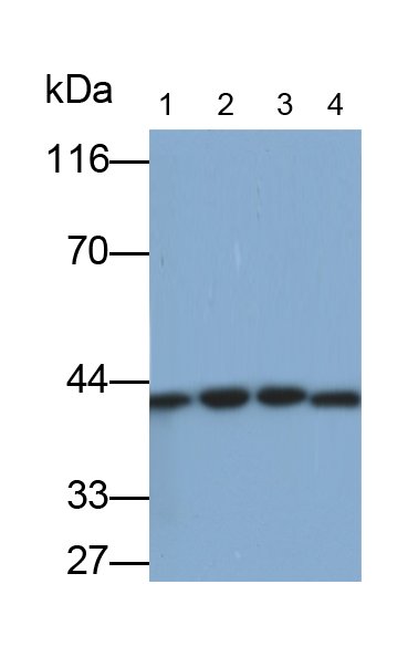 Monoclonal Antibody to Creatine Kinase B (CK-BB)