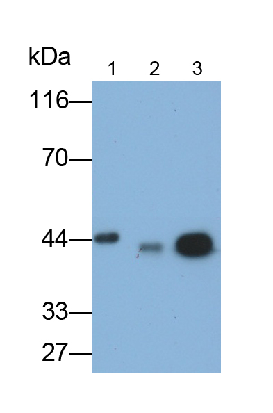 Monoclonal Antibody to Creatine Kinase B (CK-BB)