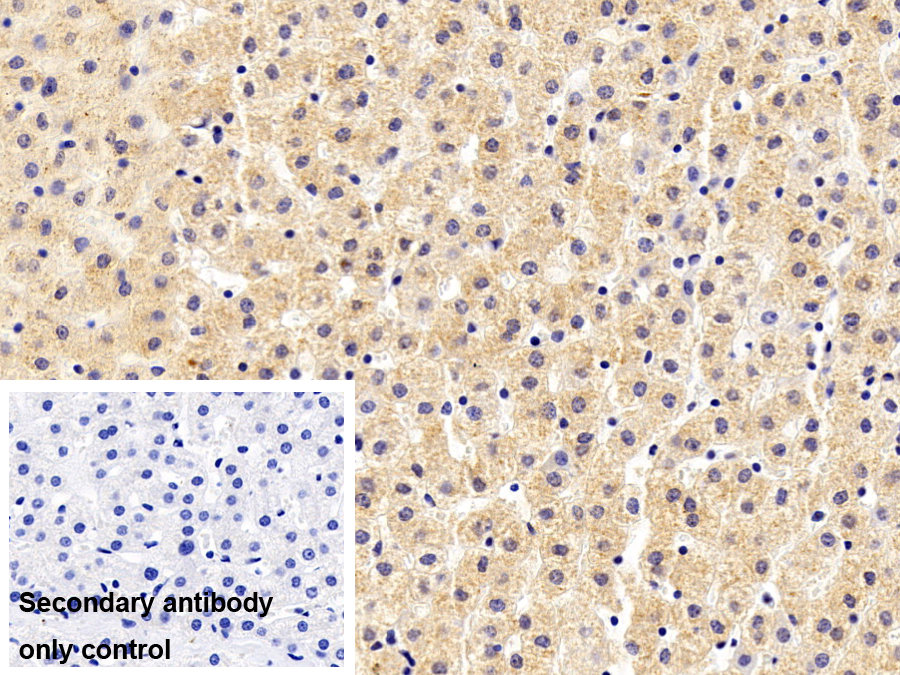 Monoclonal Antibody to Transferrin (TF)