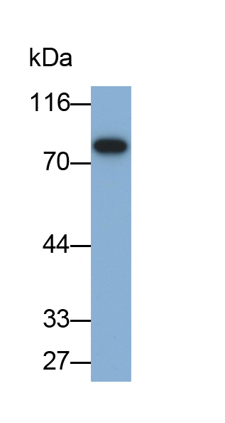 Monoclonal Antibody to Transferrin (TF)