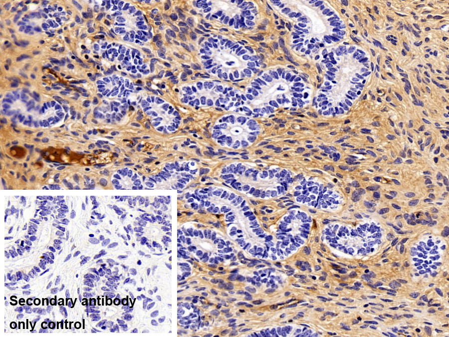 Monoclonal Antibody to Transferrin (TF)