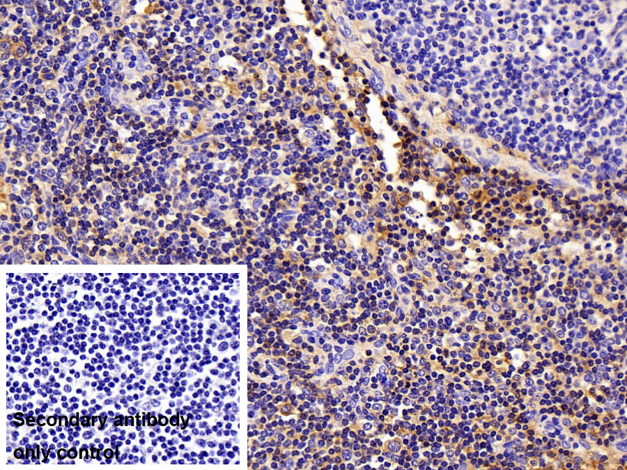 Monoclonal Antibody to Transferrin (TF)