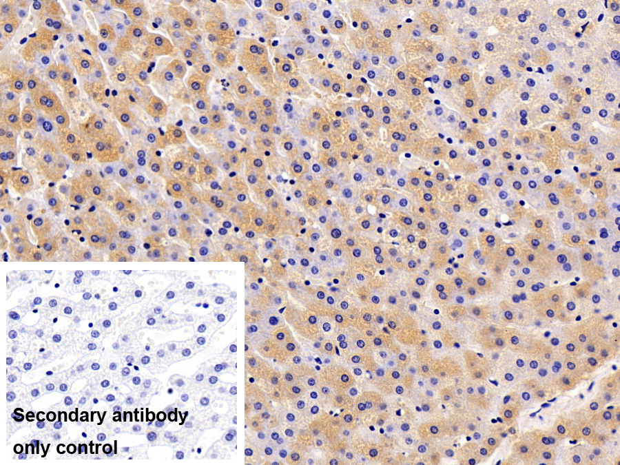 Monoclonal Antibody to Transferrin (TF)