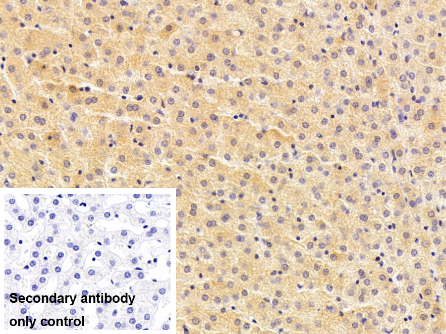 Monoclonal Antibody to Transferrin (TF)