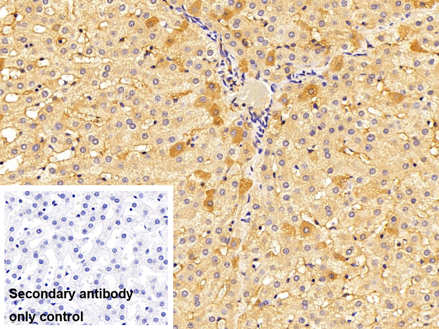 Monoclonal Antibody to Transferrin (TF)