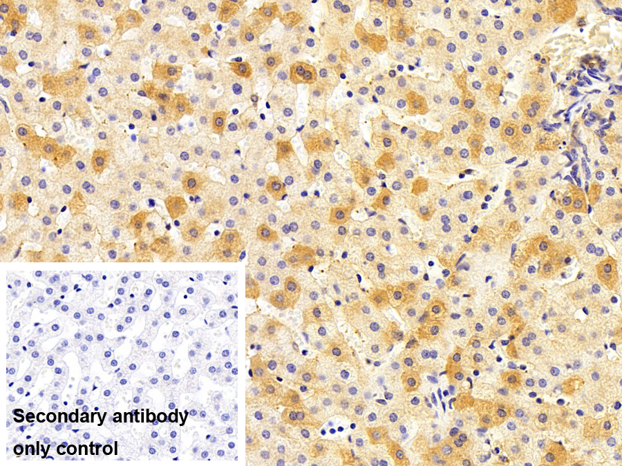 Monoclonal Antibody to Transferrin (TF)