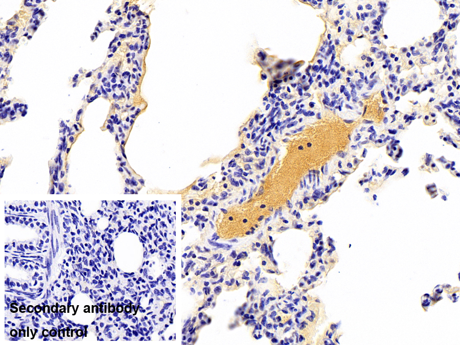 Monoclonal Antibody to Transferrin (TF)