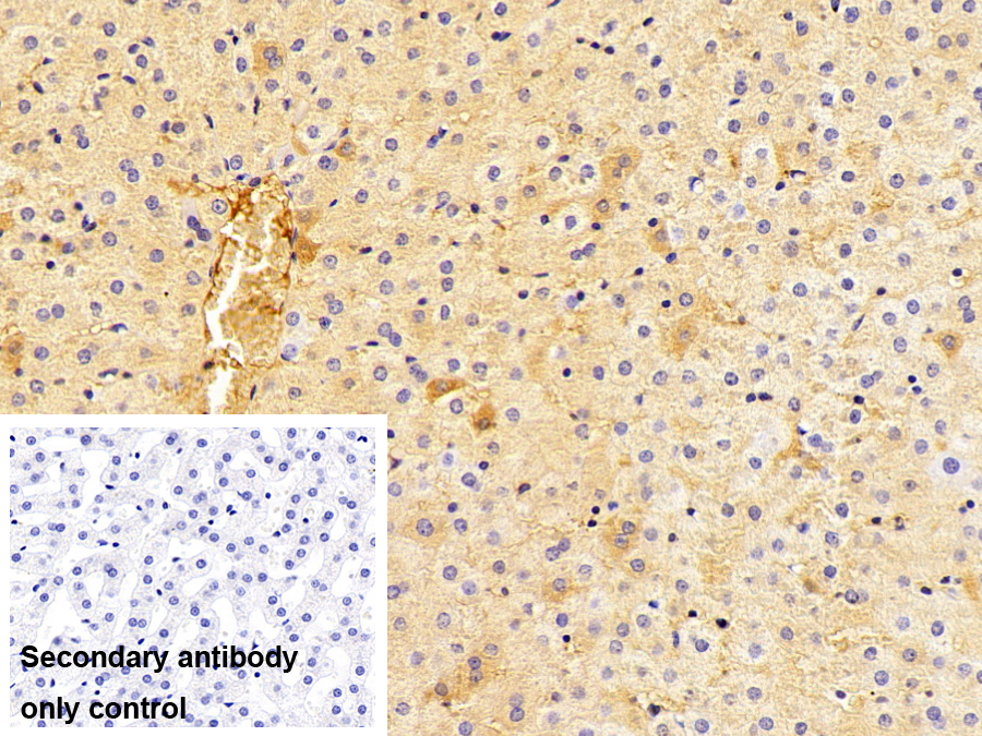 Monoclonal Antibody to Transferrin (TF)