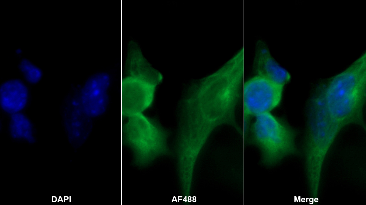 Monoclonal Antibody to S100 Calcium Binding Protein A10 (S100A10)