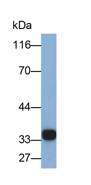 Monoclonal Antibody to HLA Class II Histocompatibility Antigen, DR Alpha Chain (HLA-DRA)