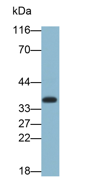 Monoclonal Antibody to HLA Class II Histocompatibility Antigen, DR Alpha Chain (HLA-DRA)